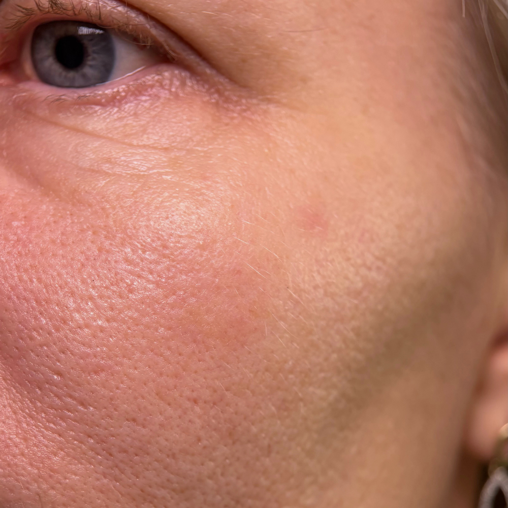 Real Skin Has Texture  And That’s Normal